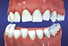Orthodontics