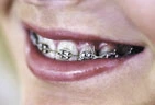 Orthodontics