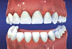 Orthodontics