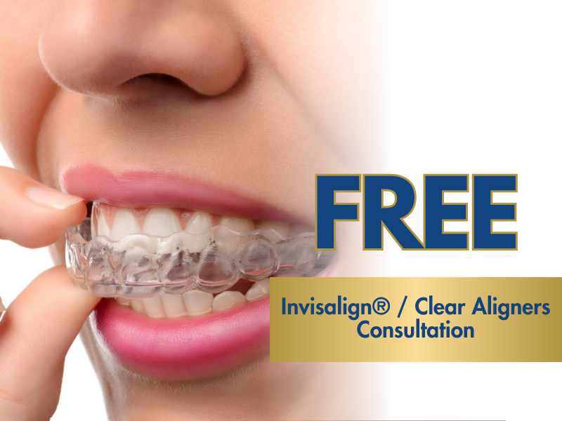 Free Invisalign and Clear Aligners Consultation Offer